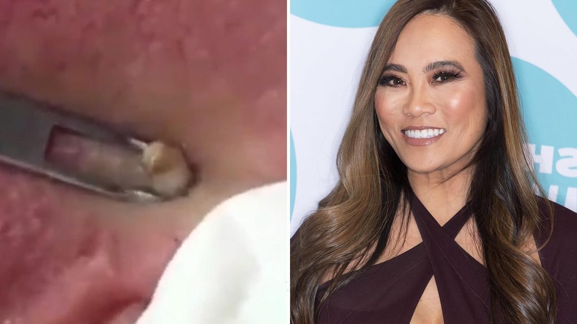 Dr Pimple Popper removes ‘heavyweight’ blackhead from man’s ear – joking ‘he’s lost weight’