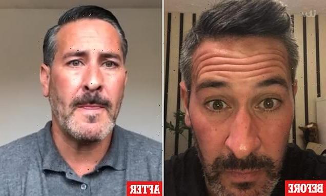 Lorry driver, 46, reveals why he get Botox