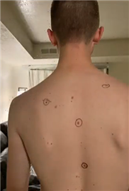 Woman sends husband to doctor with worrying moles circled – he came home with notes written on him