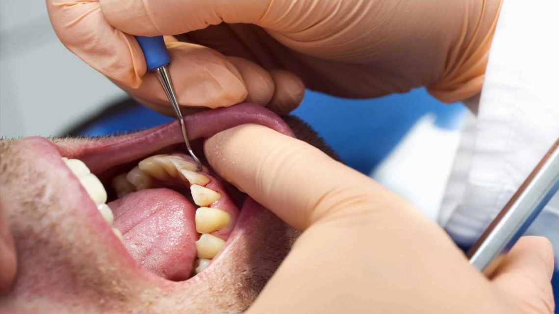 I'm a dentist – here's 5 things your mouth says about you (and when to see a doctor sharpish)
