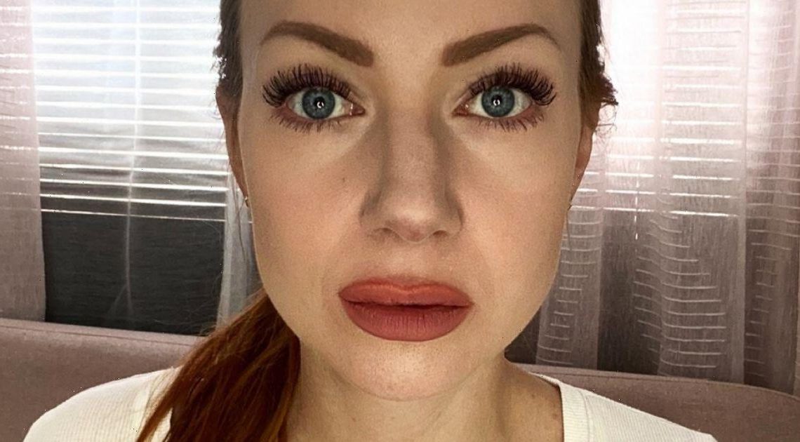 Model can’t get work after botched nose job leaves her with ‘wonky hooter’