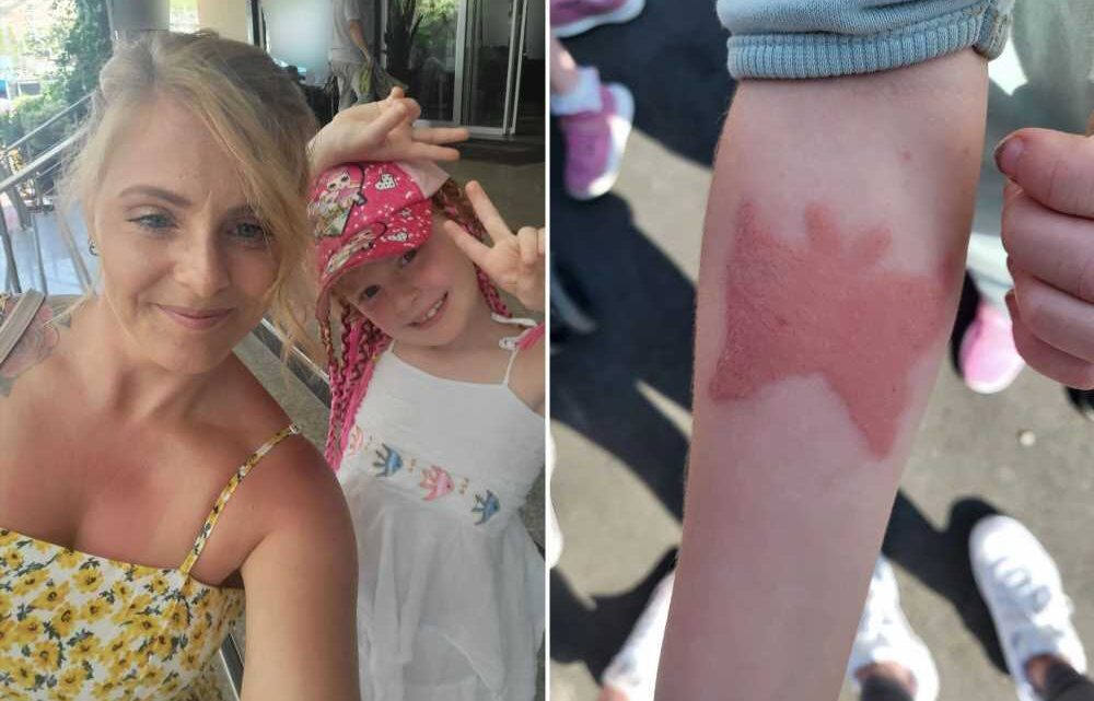 Mum’s warning after daughter, 7, suffers chemical burns & hospitalised from ‘oozing’ henna tattoo on Turkish holiday | The Sun