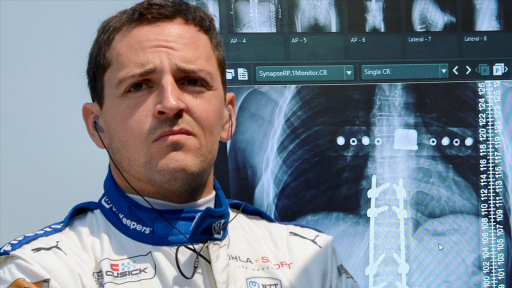 Stefan Wilson Needed 2 Titanium Rods, 8 Screws In Back After Indy 500 Practice Crash